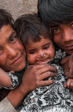 Supporting Orphans Through Charitable Contributions